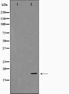 CFL2 / Cofilin 2 Antibody - Western blot analysis on Jurkat cell lysates using Cofilin antibody. The lane on the left is treated with the antigen-specific peptide.