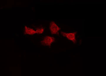 CFL2 / Cofilin 2 Antibody - Staining HeLa cells by IF/ICC. The samples were fixed with PFA and permeabilized in 0.1% Triton X-100, then blocked in 10% serum for 45 min at 25°C. The primary antibody was diluted at 1:200 and incubated with the sample for 1 hour at 37°C. An Alexa Fluor 594 conjugated goat anti-rabbit IgG (H+L) Ab, diluted at 1/600, was used as the secondary antibody.