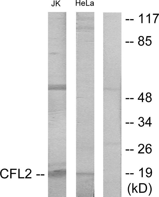 CFL2 / Cofilin 2 Antibody - Western blot analysis of extracts from Jurkat cells and HeLa cells, using Cofilin antibody.