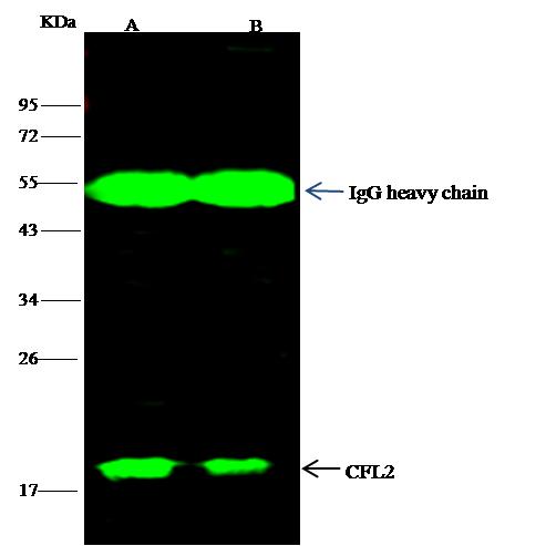 CFL2 / Cofilin 2 Antibody - CFL2 was immunoprecipitated using: Lane A: 0.5 mg Raji Whole Cell Lysate. Lane B: 0.5 mg Hela Whole Cell Lysate. 4 uL anti-CFL2 rabbit polyclonal antibody and 15 ul of 50% Protein G agarose. Primary antibody: Anti-CFL2 rabbit polyclonal antibody, at 1:100 dilution. Secondary antibody: Dylight 800-labeled antibody to rabbit IgG (H+L), at 1:5000 dilution. Developed using the odssey technique. Performed under reducing conditions. Predicted band size: 18 kDa. Observed band size: 18 kDa.