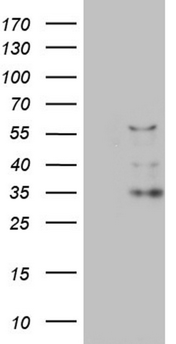 CFLAR / FLIP Antibody - HEK293T cells were transfected with the pCMV6-ENTRY control (Left lane) or pCMV6-ENTRY CFLAR (Right lane) cDNA for 48 hrs and lysed. Equivalent amounts of cell lysates (5 ug per lane) were separated by SDS-PAGE and immunoblotted with anti-CFLAR.