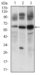CFLAR / FLIP Antibody - Western blot using CFLAR mouse monoclonal antibody against JURKAT (1), 3T3L1 (2) and RAJI (3) cell lysate.