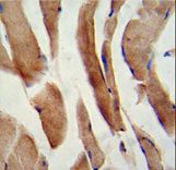 CFLAR / FLIP Antibody - Formalin-fixed and paraffin-embedded human skeletal muscle reacted with CFLAR Antibody , which was peroxidase-conjugated to the secondary antibody, followed by DAB staining. This data demonstrates the use of this antibody for immunohistochemistry; clinical relevance has not been evaluated.