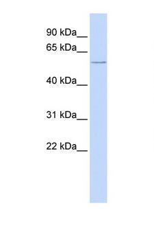 CFLAR / FLIP Antibody - CFLAR / FLIP antibody Western blot of 721_B Cell lysate. Antibody concentration 1 ug/ml. This image was taken for the unconjugated form of this product. Other forms have not been tested.