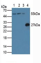 CFLAR / FLIP Antibody - Western Blot; Sample: Lane1: Human Jurkat Cells; Lane2: Human HeLa Cells; Lane3: Human K562 Cells; Lane4: Rat Spleen Tissue.