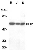 CFLAR / FLIP Antibody - Western blot analysis of FLIP in HeLa (H), Jurkat (J), and K562 (K) whole cell lysate with FLIP antibody at 1ug/ml.