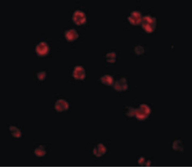 CFLAR / FLIP Antibody - Immunofluorescence of FLIP in HeLa cells with FLIP antibody at 20 ug/ml.
