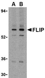 CFLAR / FLIP Antibody - Western blot of FLIP in K562 cell lysate with FLIP antibody at (A) 1 and (B) 2 ug/ml.