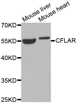 CFLAR / FLIP Antibody - Western blot analysis of extracts of various tissues.