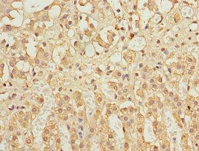 CFLAR / FLIP Antibody - Immunohistochemistry of paraffin-embedded human adrenal gland tissue using antibody at dilution of 1:100.