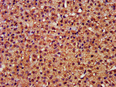 CFLAR / FLIP Antibody - IHC image of CFLAR Antibody diluted at 1:400 and staining in paraffin-embedded human adrenal gland tissue performed on a Leica BondTM system. After dewaxing and hydration, antigen retrieval was mediated by high pressure in a citrate buffer (pH 6.0). Section was blocked with 10% normal goat serum 30min at RT. Then primary antibody (1% BSA) was incubated at 4°C overnight. The primary is detected by a biotinylated secondary antibody and visualized using an HRP conjugated SP system.
