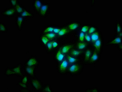 CFLAR / FLIP Antibody - Immunofluorescence staining of Hela cells with CFLAR Antibody at 1:40, counter-stained with DAPI. The cells were fixed in 4% formaldehyde, permeabilized using 0.2% Triton X-100 and blocked in 10% normal Goat Serum. The cells were then incubated with the antibody overnight at 4°C. The secondary antibody was Alexa Fluor 488-congugated AffiniPure Goat Anti-Rabbit IgG(H+L).