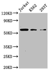 CFLAR / FLIP Antibody - Western Blot Positive WB detected in: Jurkat whole cell lysate, K562 whole cell lysate, 293T whole cell lysate All lanes: CFLAR antibody at 4µg/ml Secondary Goat polyclonal to rabbit IgG at 1/50000 dilution Predicted band size: 56, 26, 42, 28, 52, 51, 40, 31, 35, 53, 34, 24, 50, 45 kDa Observed band size: 56 kDa
