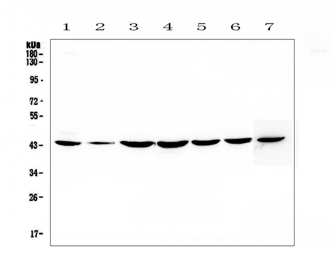 CFLAR / FLIP Antibody - Western blot analysis of FLIP using anti-FLIP antibody. Electrophoresis was performed on a 5-20% SDS-PAGE gel at 70V (Stacking gel) / 90V (Resolving gel) for 2-3 hours. The sample well of each lane was loaded with 50ug of sample under reducing conditions. Lane 1: human Hela whole cell lysates,Lane 2: human placenta tissue lysates, Lane 3: human COLO-320 whole cell lysates,Lane 4: human PANC-1 whole cell lysates,Lane 5: human HepG2 whole cell lysates,Lane 6: human MDA-MB-231 whole cell lysates,Lane 7: mouse NIH3T3 whole cell lysates. After Electrophoresis, proteins were transferred to a Nitrocellulose membrane at 150mA for 50-90 minutes. Blocked the membrane with 5% Non-fat Milk/ TBS for 1.5 hour at RT. The membrane was incubated with rabbit anti-FLIP antigen affinity purified polyclonal antibody at 0.5 ?g/mL overnight at 4?C, then washed with TBS-0.1% Tween 3 times with 5 minutes each and probed with a goat anti-rabbit IgG-HRP secondary antibody at a dilution of 1:10000 for 1.5 hour at RT. The signal is developed using an Enhanced Chemiluminescent detection (ECL) kit with Tanon 5200 system. A specific band was detected for FLIP at approximately 43KD. The expected band size for FLIP is at 55KD.