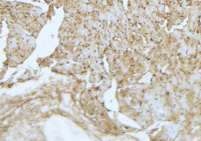 CFLAR / FLIP Antibody - 1:100 staining mouse muscle tissue by IHC-P. The sample was formaldehyde fixed and a heat mediated antigen retrieval step in citrate buffer was performed. The sample was then blocked and incubated with the antibody for 1.5 hours at 22°C. An HRP conjugated goat anti-rabbit antibody was used as the secondary.