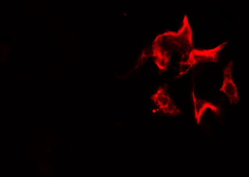 CFLAR / FLIP Antibody - Staining HeLa cells by IF/ICC. The samples were fixed with PFA and permeabilized in 0.1% Triton X-100, then blocked in 10% serum for 45 min at 25°C. The primary antibody was diluted at 1:200 and incubated with the sample for 1 hour at 37°C. An Alexa Fluor 594 conjugated goat anti-rabbit IgG (H+L) antibody, diluted at 1/600, was used as secondary antibody.
