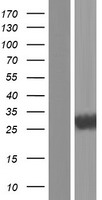 CFLAR / FLIP Protein - Western validation with an anti-DDK antibody * L: Control HEK293 lysate R: Over-expression lysate