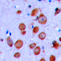 CFTR Antibody - Immunohistochemical analysis of CFTR staining in human brain formalin fixed paraffin embedded tissue section. The section was pre-treated using heat mediated antigen retrieval with sodium citrate buffer (pH 6.0). The section was then incubated with the antibody at room temperature and detected using an HRP conjugated compact polymer system. DAB was used as the chromogen. The section was then counterstained with hematoxylin and mounted with DPX. w