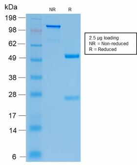CFTR Antibody - SDS-PAGE Analysis Purified CFTR Rabbit Recombinant Monoclonal Antibody (CFTR/2290R). Confirmation of Purity and Integrity of Antibody.