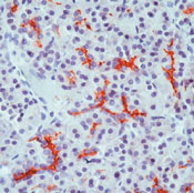 CFTR Antibody - Formalin-fixed, paraffin-embedded human pancreas stained with peroxidase-conjugate and AEC chromogen. Note membrane staining of epithelial cells in the intercalated ducts.  This image was taken for the unmodified form of this product. Other forms have not been tested.