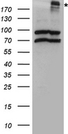 CFTR Antibody - HEK293T cells were transfected with the pCMV6-ENTRY control. (Left lane) or pCMV6-ENTRY CFTR. (Right lane) cDNA for 48 hrs and lysed. Equivalent amounts of cell lysates. (5 ug per lane) were separated by SDS-PAGE and immunoblotted with anti-CFTR rabbit polyclonal antibody.