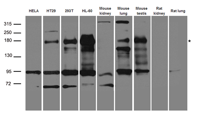 CFTR Antibody - Western blot analysis of extracts. (35ug) from different cell lines and tissues by using anti-CFTR rabbit polyclonal antibody.