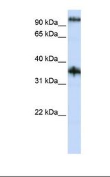 CG6 / C9orf4 Antibody - Jurkat cell lysate. Antibody concentration: 1.0 ug/ml. Gel concentration: 12%.  This image was taken for the unconjugated form of this product. Other forms have not been tested.