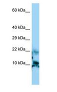 CGA / hCG Alpha Antibody - CGA / hCG antibody Western Blot of HepG2.  This image was taken for the unconjugated form of this product. Other forms have not been tested.
