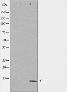 CGA / hCG Alpha Antibody - Western blot analysis of JAR lysate using CGA antibody. The lane on the left is treated with the antigen-specific peptide.