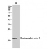 CGB / hCG Beta Antibody - Western blot of Choriogonadotropin beta antibody