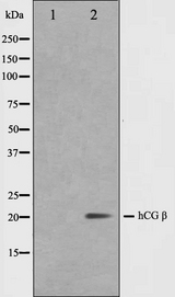 CGB / hCG Beta Antibody - Western blot analysis on NIH-3T3 cell lysates using hCG beta antibody. The lane on the left is treated with the antigen-specific peptide.