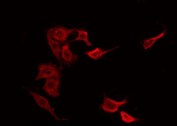 CGB / hCG Beta Antibody - Staining NIH-3T3 cells by IF/ICC. The samples were fixed with PFA and permeabilized in 0.1% Triton X-100, then blocked in 10% serum for 45 min at 25°C. The primary antibody was diluted at 1:200 and incubated with the sample for 1 hour at 37°C. An Alexa Fluor 594 conjugated goat anti-rabbit IgG (H+L) Ab, diluted at 1/600, was used as the secondary antibody.