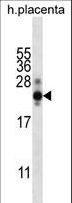 CGB / hCG Beta Antibody - CGB/HCG-Beta Antibody western blot of human placenta tissue lysates (35 ug/lane). The CGB/HCG-Beta antibody detected the CGB/HCG-Beta protein (arrow).