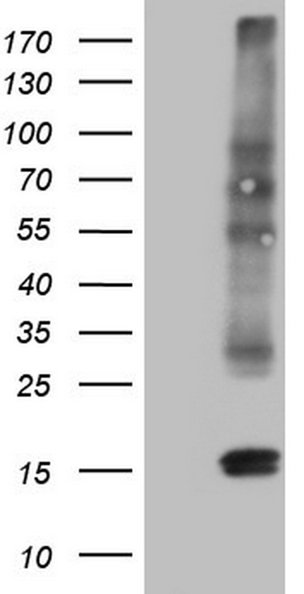 CGB / hCG Beta Antibody - HEK293T cells were transfected with the pCMV6-ENTRY control. (Left lane) or pCMV6-ENTRY CGB. (Right lane) cDNA for 48 hrs and lysed. Equivalent amounts of cell lysates. (5 ug per lane) were separated by SDS-PAGE and immunoblotted with anti-CGB.