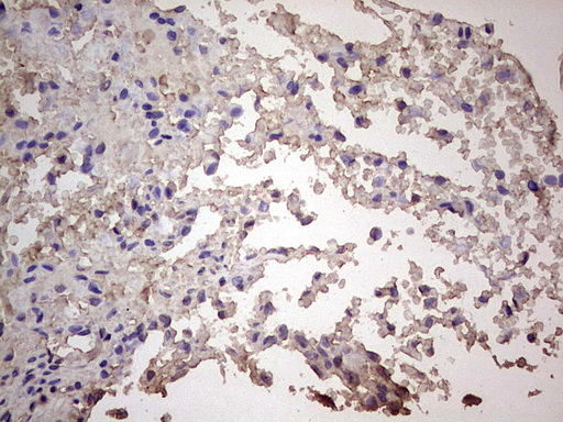 CGB / hCG Beta Antibody - Immunohistochemical staining of paraffin-embedded Human adult brain tissue using anti-CGB mouse monoclonal antibody. (Heat-induced epitope retrieval by 1 mM EDTA in 10mM Tris, pH8.5, 120C for 3min,