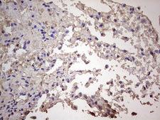 CGB / hCG Beta Antibody - IHC of paraffin-embedded Human adult brain tissue using anti-CGB mouse monoclonal antibody. (Heat-induced epitope retrieval by 1 mM EDTA in 10mM Tris, pH8.5, 120°C for 3min).