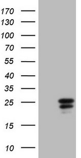 CGB / hCG Beta Antibody - HEK293T cells were transfected with the pCMV6-ENTRY control (Left lane) or pCMV6-ENTRY CGB (Right lane) cDNA for 48 hrs and lysed. Equivalent amounts of cell lysates (5 ug per lane) were separated by SDS-PAGE and immunoblotted with anti-CGB.