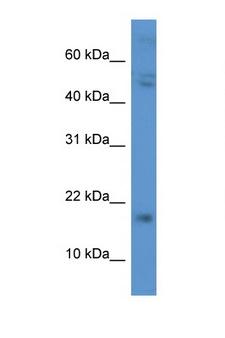 CGB / hCG Beta Antibody - CGB / hCG Beta antibody Western blot of 435S Cell lysate. Antibody concentration 1 ug/ml.  This image was taken for the unconjugated form of this product. Other forms have not been tested.