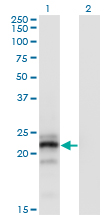 CGB / hCG Beta Antibody - Western Blot analysis of CGB expression in transfected 293T cell line by CGB monoclonal antibody (M05), clone 3B4.Lane 1: CGB transfected lysate(17.7 KDa).Lane 2: Non-transfected lysate.