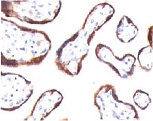 CGB / hCG Beta Antibody - IHC testing of FFPE human placenta and HCG-beta antibody (CGB63).  This image was taken for the unmodified form of this product. Other forms have not been tested.