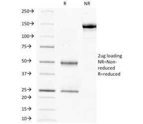 CGB / hCG Beta Antibody - SDS-PAGE Analysis of Purified, BSA-Free HCG-beta Antibody (clone HCGb/211). Confirmation of Integrity and Purity of the Antibody.
