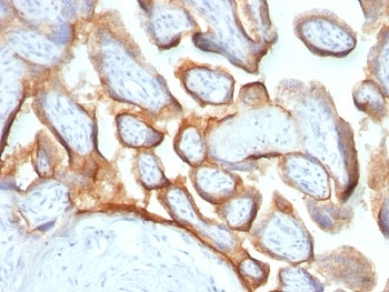 CGB / hCG Beta Antibody - Formalin-fixed, paraffin-embedded human placenta stained with hCG beta antibody (HCGb/54 + HCGb/459).  This image was taken for the unmodified form of this product. Other forms have not been tested.