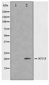 CGB / hCG Beta Antibody - Western blot of NIH-3T3 cell lysate using hCG beta Antibody