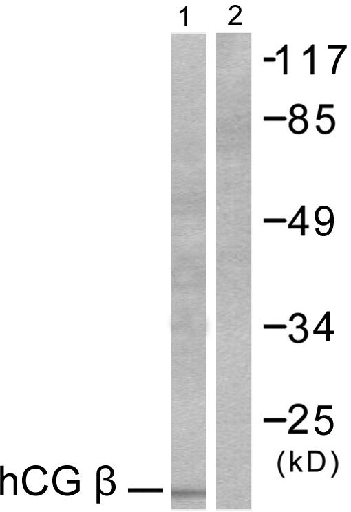 CGB / hCG Beta Antibody - Western blot analysis of extracts from NIH/3T3 cells, using hCG ß antibody.