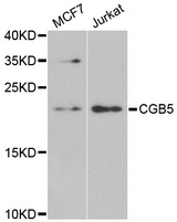 CGB5 Antibody - Western blot analysis of extracts of various cell lines.