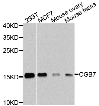 CGB7 Antibody - Western blot analysis of extracts of various cells.