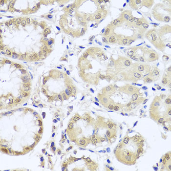 CGB7 Antibody - Immunohistochemistry of paraffin-embedded human stomach tissue.
