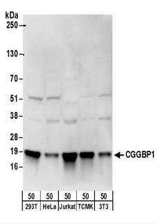CGGBP1 Antibody - Detection of Human and Mouse CGGBP1 by Western Blot. Samples: Whole cell lysate (50 ug) from 293T, HeLa, Jurkat, mouse TCMK-1, and mouse NIH3T3 cells. Antibodies: Affinity purified rabbit anti-CGGBP1 antibody used for WB at 0.4 ug/ml. Detection: Chemiluminescence with an exposure time of 10 seconds.