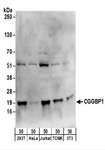 CGGBP1 Antibody - Detection of Human and Mouse CGGBP1 by Western Blot. Samples: Whole cell lysate (50 ug) from 293T, HeLa, Jurkat, mouse TCMK-1, and mouse NIH3T3 cells. Antibodies: Affinity purified rabbit anti-CGGBP1 antibody used for WB at 1 ug/ml. Detection: Chemiluminescence with an exposure time of 10 seconds.