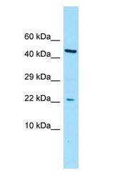 CGGBP1 Antibody - CGGBP1 antibody Western Blot of ACHN.  This image was taken for the unconjugated form of this product. Other forms have not been tested.